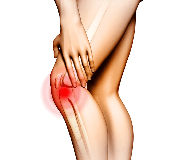 Stage of arthrosis