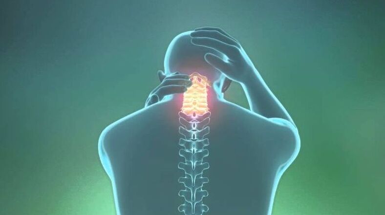 Osteochondrosis of the cervical area